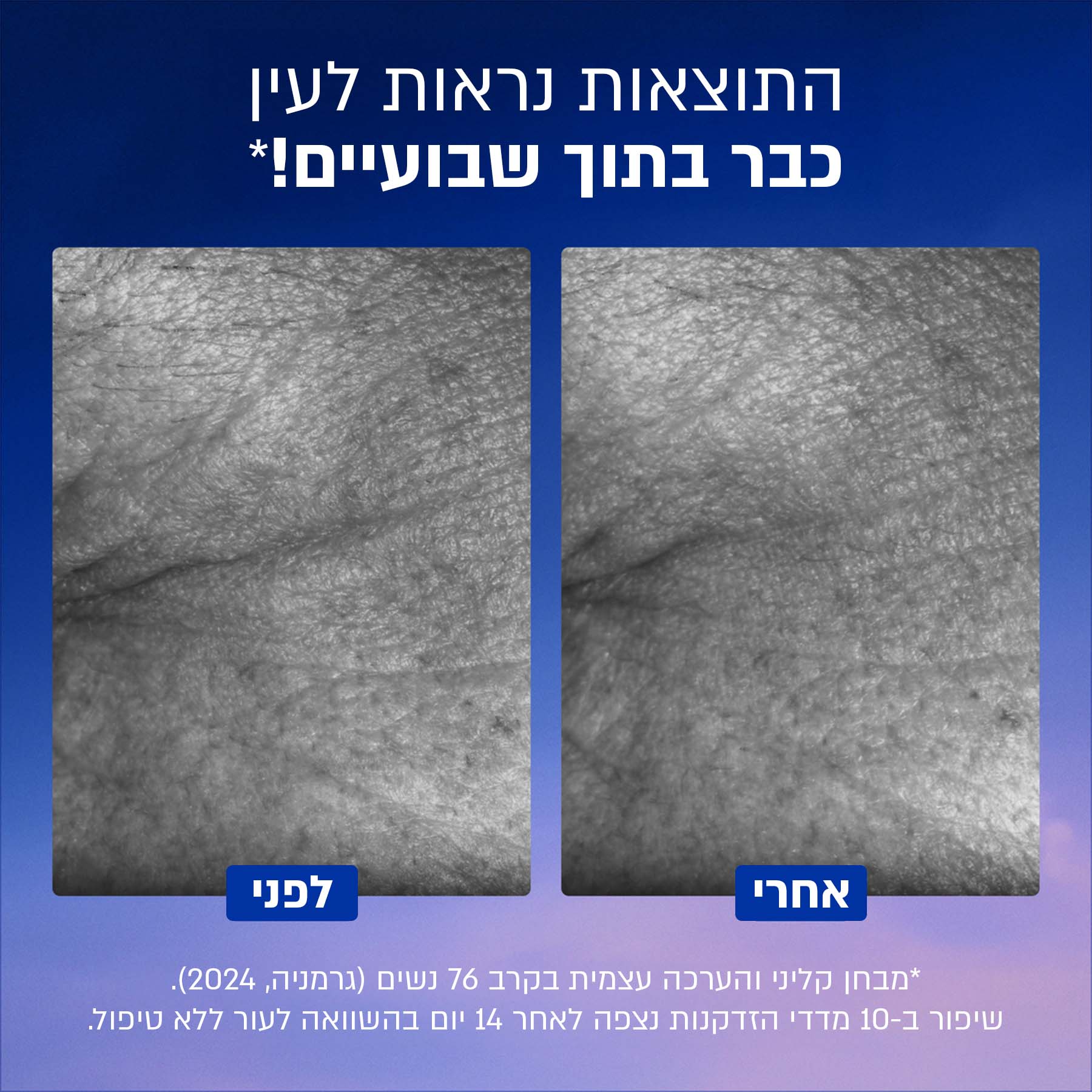 תמונת מוצר 5